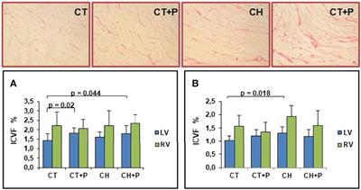 Air Pollution’s Impact on Cardiac Remodeling in an Experimental Model of Chagas Cardiomyopathy